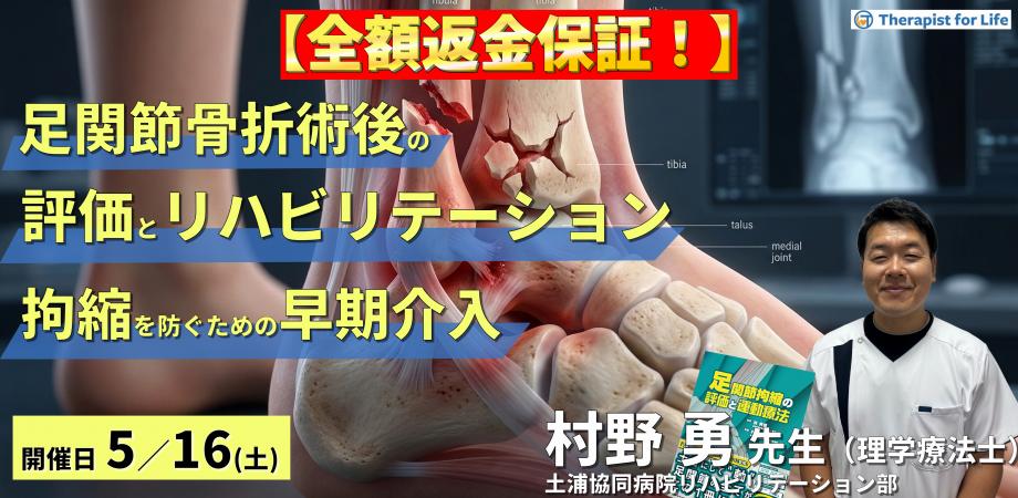 【※締切り間近】足関節骨折術後の評価とリハビリテーション～拘縮を防ぐための早期介入と運動療法～　講師：村野勇先生