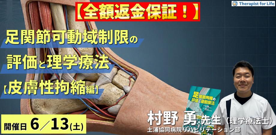 ※早割中【皮膚性拘縮編】足関節可動域制限の評価と運動療法～皮膚性・筋性拘縮の鑑別とエコー・触診による臨床介入～　講師：村野勇先生